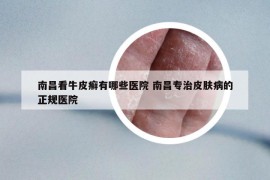 南昌看牛皮癣有哪些医院 南昌专治皮肤病的正规医院
