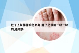 肚子上长得像癣怎么办 肚子上像癣一块一块的,还增多