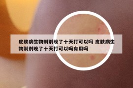 皮肤病生物制剂晚了十天打可以吗 皮肤病生物制剂晚了十天打可以吗有用吗