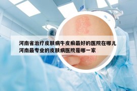 河南省治疗皮肤病牛皮癣最好的医院在哪儿 河南最专业的皮肤病医院是哪一家