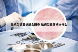 脓疱型银屑病膳食调查 脓疱型银屑病吃什么好
