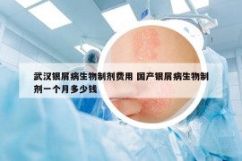 武汉银屑病生物制剂费用 国产银屑病生物制剂一个月多少钱