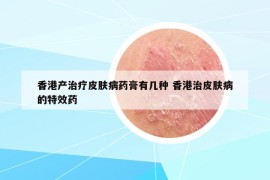 香港产治疗皮肤病药膏有几种 香港治皮肤病的特效药