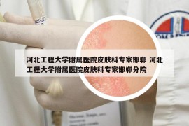 河北工程大学附属医院皮肤科专家邯郸 河北工程大学附属医院皮肤科专家邯郸分院