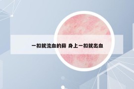 一扣就流血的藓 身上一扣就出血