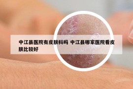 中江县医院有皮肤科吗 中江县哪家医院看皮肤比较好
