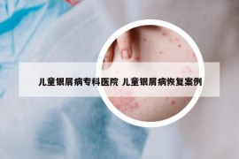 儿童银屑病专科医院 儿童银屑病恢复案例