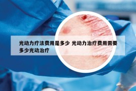 光动力疗法费用是多少 光动力治疗费用需要多少光动治疗