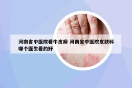 河南省中医院看牛皮癣 河南省中医院皮肤科哪个医生看的好