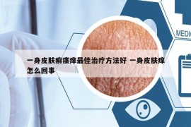一身皮肤癣瘙痒最佳治疗方法好 一身皮肤痒怎么回事