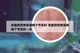 安医附院银屑病哪个专家好 安医附院银屑病哪个专家好一点