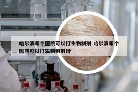 哈尔滨哪个医院可以打生物制剂 哈尔滨哪个医院可以打生物制剂针