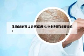 生物制剂可以走医保吗 生物制剂可以报销吗?