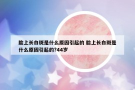 脸上长白斑是什么原因引起的 脸上长白斑是什么原因引起的?44岁