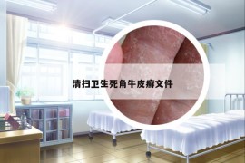 清扫卫生死角牛皮癣文件