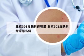 北京301皮肤科在哪里 北京301皮肤科专家怎么样