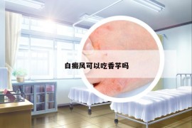 白癜风可以吃香芋吗