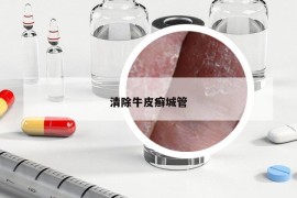 清除牛皮癣城管