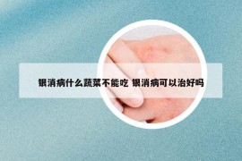 银消病什么蔬菜不能吃 银消病可以治好吗