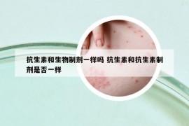 抗生素和生物制剂一样吗 抗生素和抗生素制剂是否一样