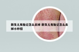 新生儿有胎记怎么去掉 新生儿有胎记怎么去掉小妙招