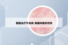 葡蟠治疗牛皮癣 葡蟠树根的功效