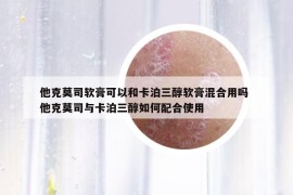 他克莫司软膏可以和卡泊三醇软膏混合用吗 他克莫司与卡泊三醇如何配合使用