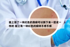 腿上张了一块红色的像癣可以撕下来一层皮一样的 腿上有一块红色的癣块不疼不痒