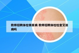 教师招聘体检银屑病 教师招聘体检检查艾滋病吗