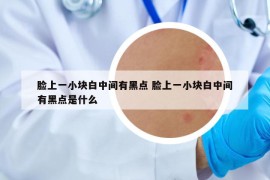 脸上一小块白中间有黑点 脸上一小块白中间有黑点是什么