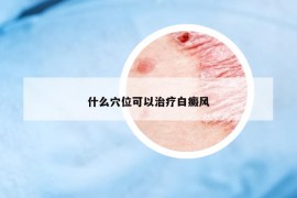 什么穴位可以治疗白癜风