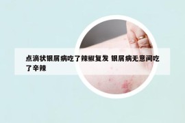 点滴状银屑病吃了辣椒复发 银屑病无意间吃了辛辣