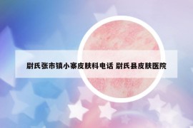 尉氏张市镇小寨皮肤科电话 尉氏县皮肤医院