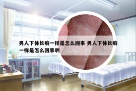 男人下体长癣一样是怎么回事 男人下体长癣一样是怎么回事啊