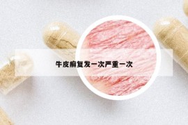 牛皮癣复发一次严重一次