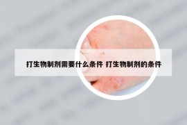 打生物制剂需要什么条件 打生物制剂的条件