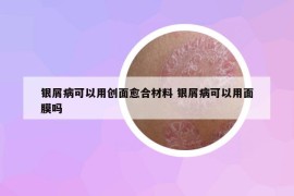 银屑病可以用创面愈合材料 银屑病可以用面膜吗