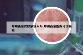 郑州西京皮肤病坑人吗 郑州西京医院可信赖吗