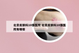 北京皮肤科10强医院 北京皮肤科10强医院有哪些