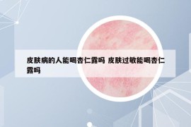 皮肤病的人能喝杏仁露吗 皮肤过敏能喝杏仁露吗