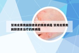 禁用皮质类固醇激素的银屑病是 禁用皮质类固醇激素治疗的疾病是