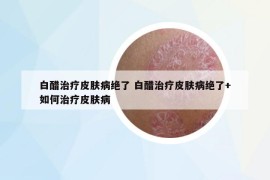 白醋治疗皮肤病绝了 白醋治疗皮肤病绝了+如何治疗皮肤病