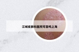 江城皮肤科医院可靠吗上海