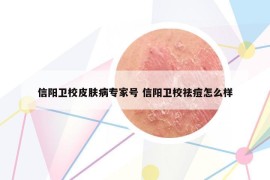 信阳卫校皮肤病专家号 信阳卫校祛痘怎么样