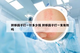 转移因子打一针多少钱 转移因子打一支有效吗