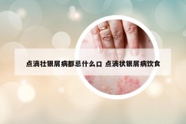 点滴壮银屑病都忌什么口 点滴状银屑病饮食