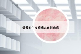 做爱对牛皮癣病人有影响吗