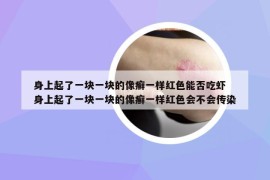 身上起了一块一块的像癣一样红色能否吃虾 身上起了一块一块的像癣一样红色会不会传染