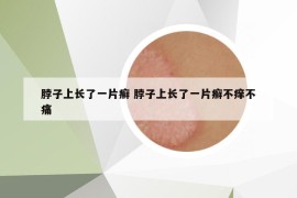 脖子上长了一片癣 脖子上长了一片癣不痒不痛