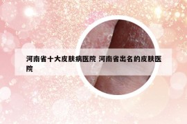 河南省十大皮肤病医院 河南省出名的皮肤医院